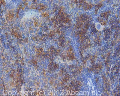 Immunohistochemistry (Formalin/PFA-fixed paraffin-embedded sections) - Anti-CD36 antibody (AB124515)