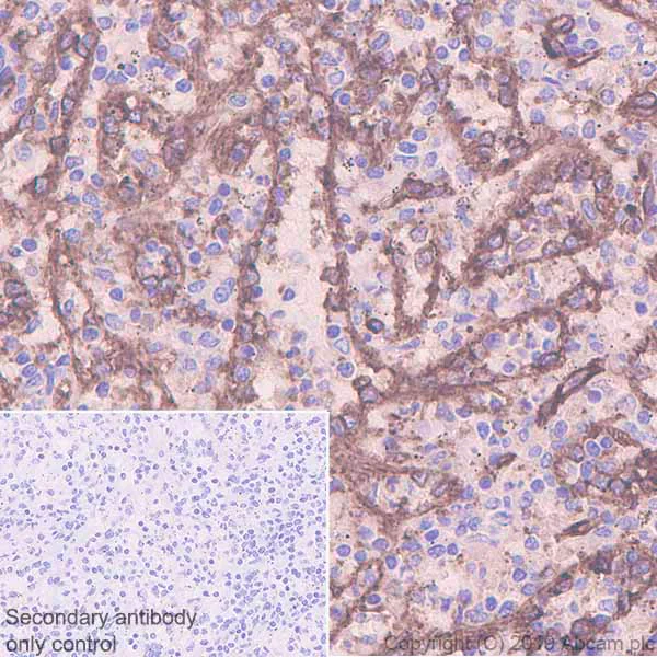 Immunohistochemistry (Formalin/PFA-fixed paraffin-embedded sections) - Anti-CD36 antibody [EPR22509-40] (AB252922)
