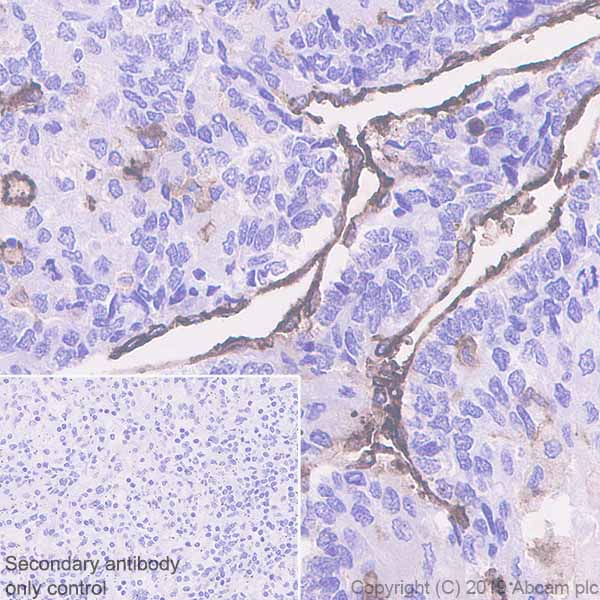 Immunohistochemistry (Formalin/PFA-fixed paraffin-embedded sections) - Anti-CD36 antibody [EPR22509-40] - BSA and Azide free (AB255331)