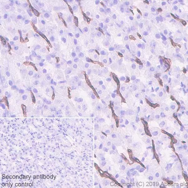 Immunohistochemistry (Formalin/PFA-fixed paraffin-embedded sections) - Anti-CD36 antibody [EPR22509-40] - BSA and Azide free (AB255331)