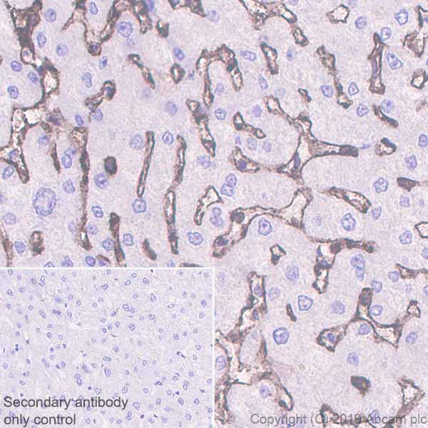 Immunohistochemistry (Formalin/PFA-fixed paraffin-embedded sections) - Anti-CD36 antibody [EPR22512-58] - BSA and Azide free (AB255332), expandable thumbnail