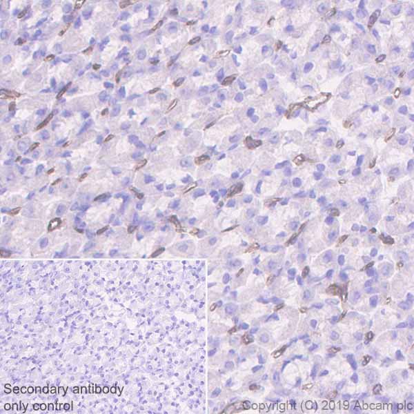 Immunohistochemistry (Formalin/PFA-fixed paraffin-embedded sections) - Anti-CD36 antibody [EPR22512-58] - BSA and Azide free (AB255332), expandable thumbnail