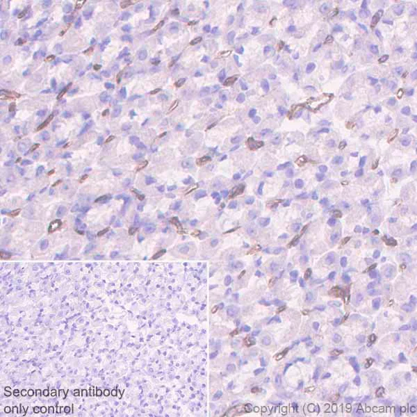 Immunohistochemistry (Formalin/PFA-fixed paraffin-embedded sections) - Anti-CD36 antibody [EPR22512-58] - BSA and Azide free (AB255332)