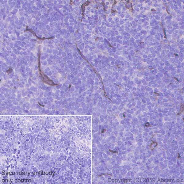 Anti-CD36 antibody [EPR22512-58] - BSA and Azide free