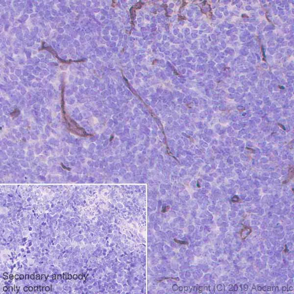 Immunohistochemistry (Formalin/PFA-fixed paraffin-embedded sections) - Anti-CD36 antibody [EPR22512-58] - BSA and Azide free (AB255332)