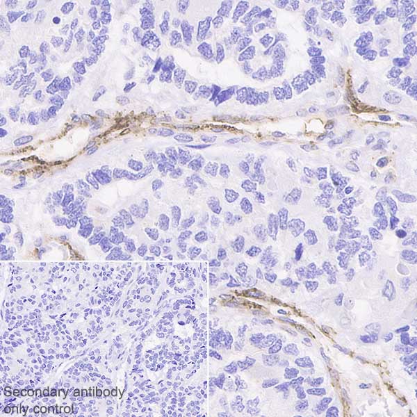 Immunohistochemistry (Formalin/PFA-fixed paraffin-embedded sections) - Anti-CD36 antibody [EPR6573] - Low endotoxin, Azide free (AB221605), expandable thumbnail