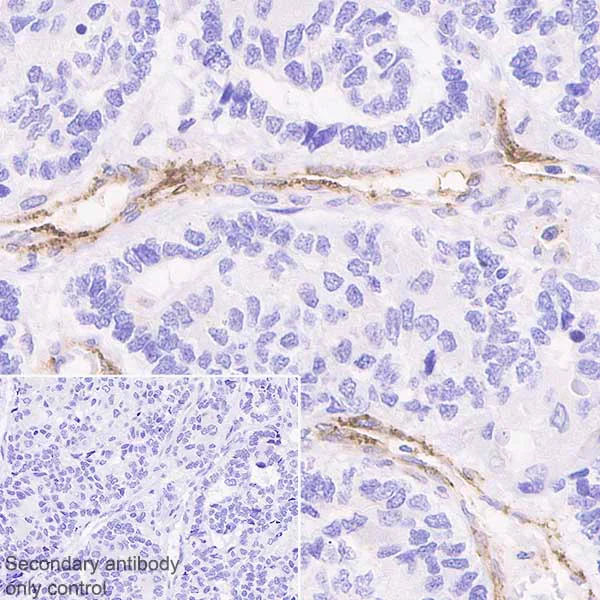 Immunohistochemistry (Formalin/PFA-fixed paraffin-embedded sections) - Anti-CD36 antibody [EPR6573] - Low endotoxin, Azide free (AB221605)