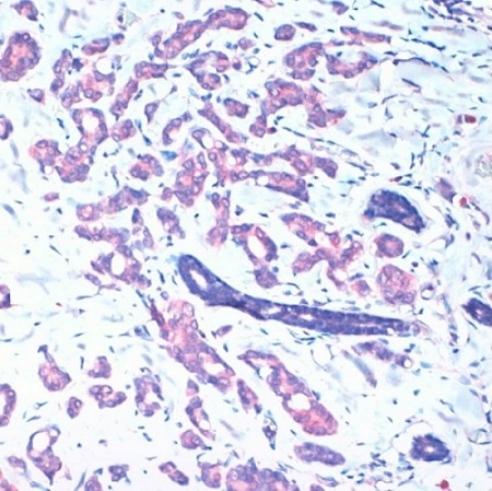 Immunohistochemistry (Formalin/PFA-fixed paraffin-embedded sections) - Anti-CD36 antibody [FA6-152] (AB17044), expandable thumbnail