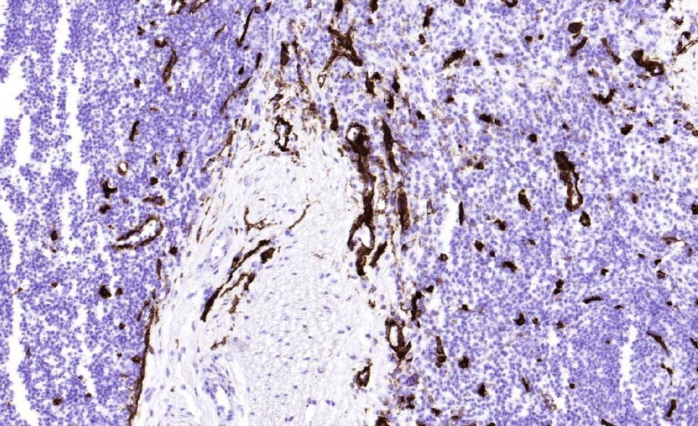 Immunohistochemistry (Frozen sections) - Anti-CD36 antibody [FA6-152] (AB17044), expandable thumbnail