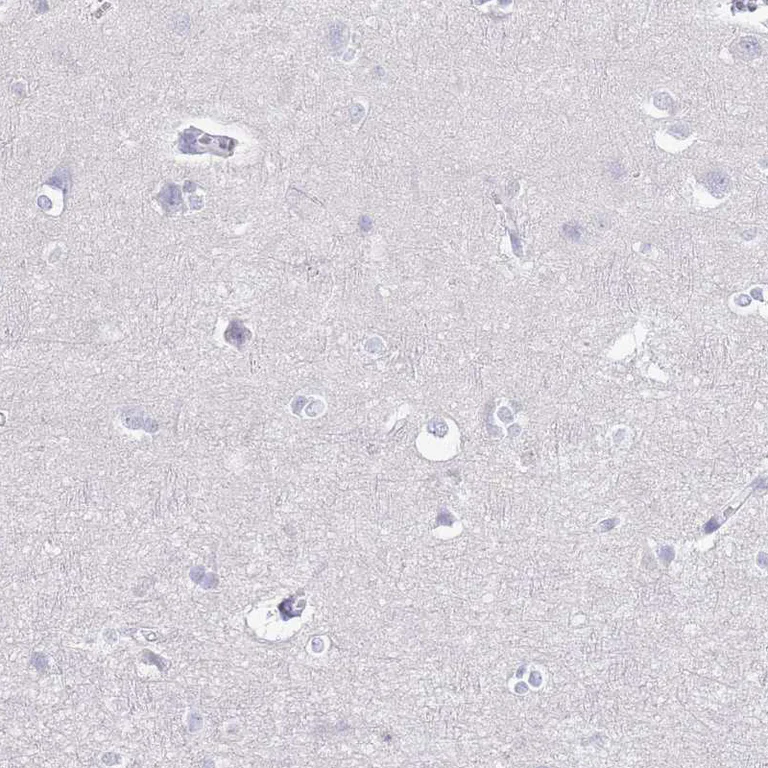 Immunohistochemistry (Formalin/PFA-fixed paraffin-embedded sections) - Anti-CD37 antibody (AB251819)