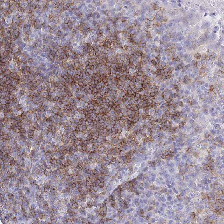 Immunohistochemistry (Formalin/PFA-fixed paraffin-embedded sections) - Anti-CD37 antibody (AB251819)