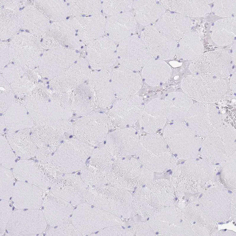 Immunohistochemistry (Formalin/PFA-fixed paraffin-embedded sections) - Anti-CD37 antibody (AB251819)