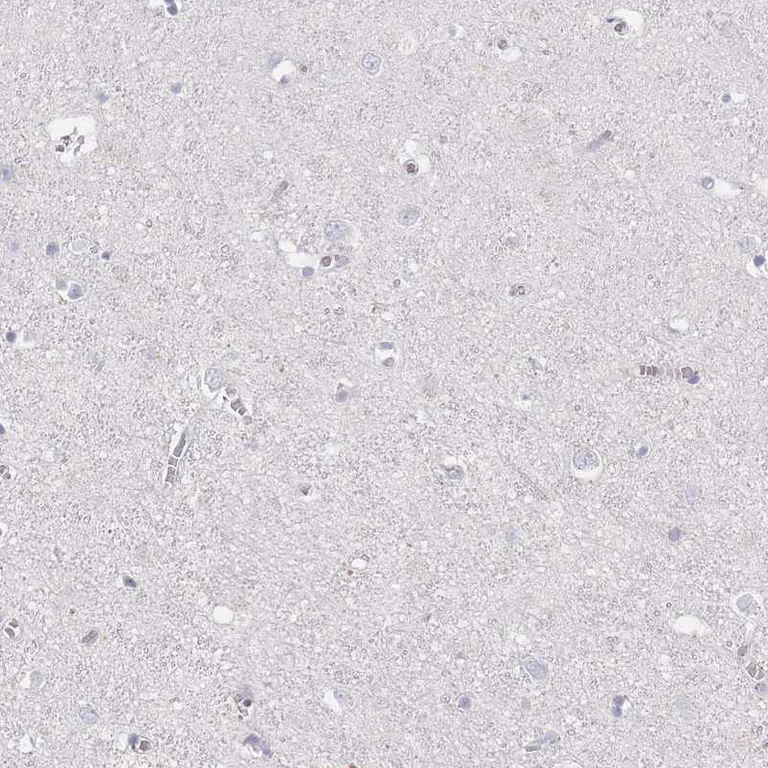 Immunohistochemistry (Formalin/PFA-fixed paraffin-embedded sections) - Anti-CD37 antibody (AB251820)