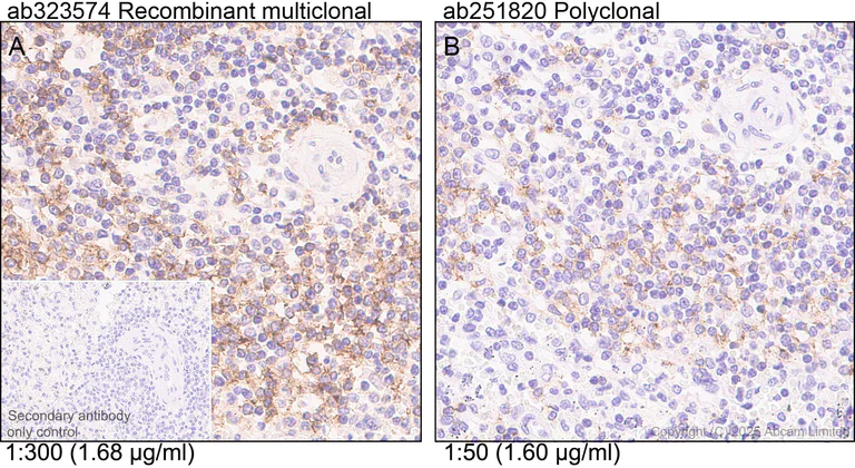 Immunohistochemistry (Formalin/PFA-fixed paraffin-embedded sections) - Anti-CD37 antibody (AB251820)
