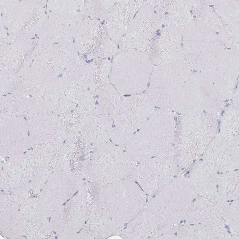 Immunohistochemistry (Formalin/PFA-fixed paraffin-embedded sections) - Anti-CD37 antibody (AB251820)
