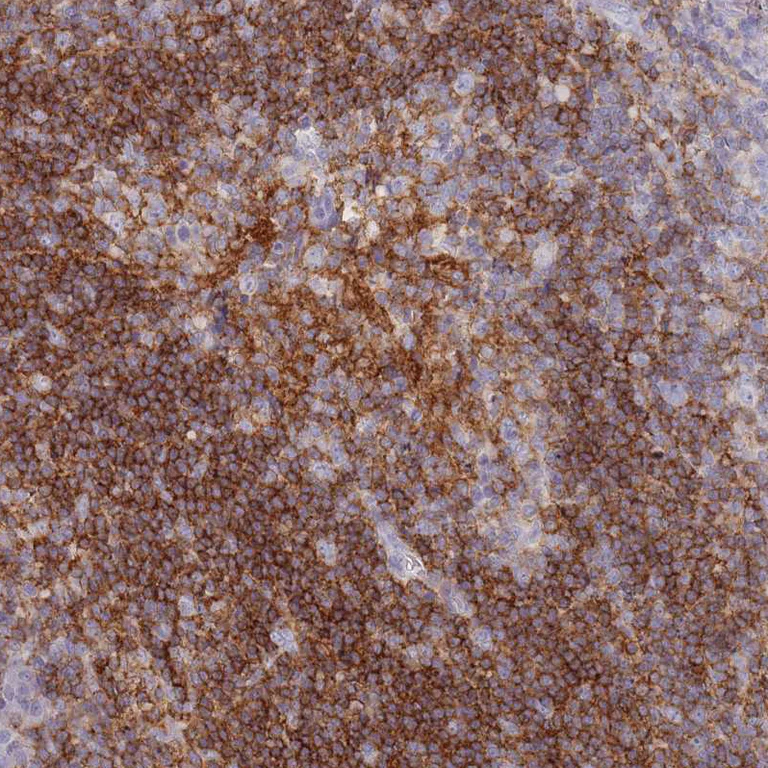 Immunohistochemistry (Formalin/PFA-fixed paraffin-embedded sections) - Anti-CD37 antibody (AB251820)