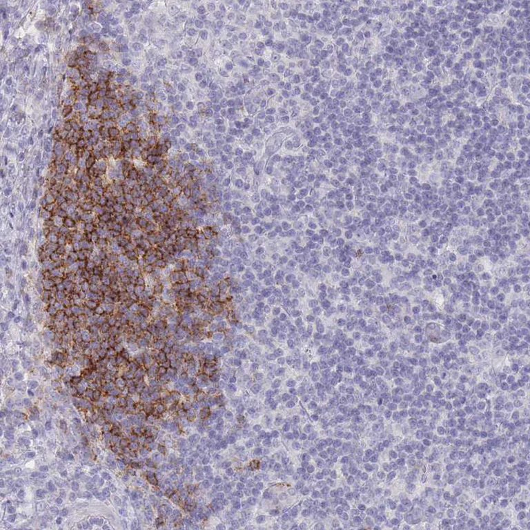 Immunohistochemistry (Formalin/PFA-fixed paraffin-embedded sections) - Anti-CD37 antibody (AB251820)