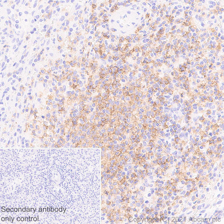 Immunohistochemistry (Formalin/PFA-fixed paraffin-embedded sections) - Anti-CD37 antibody [EPR25397-136] (AB288439)