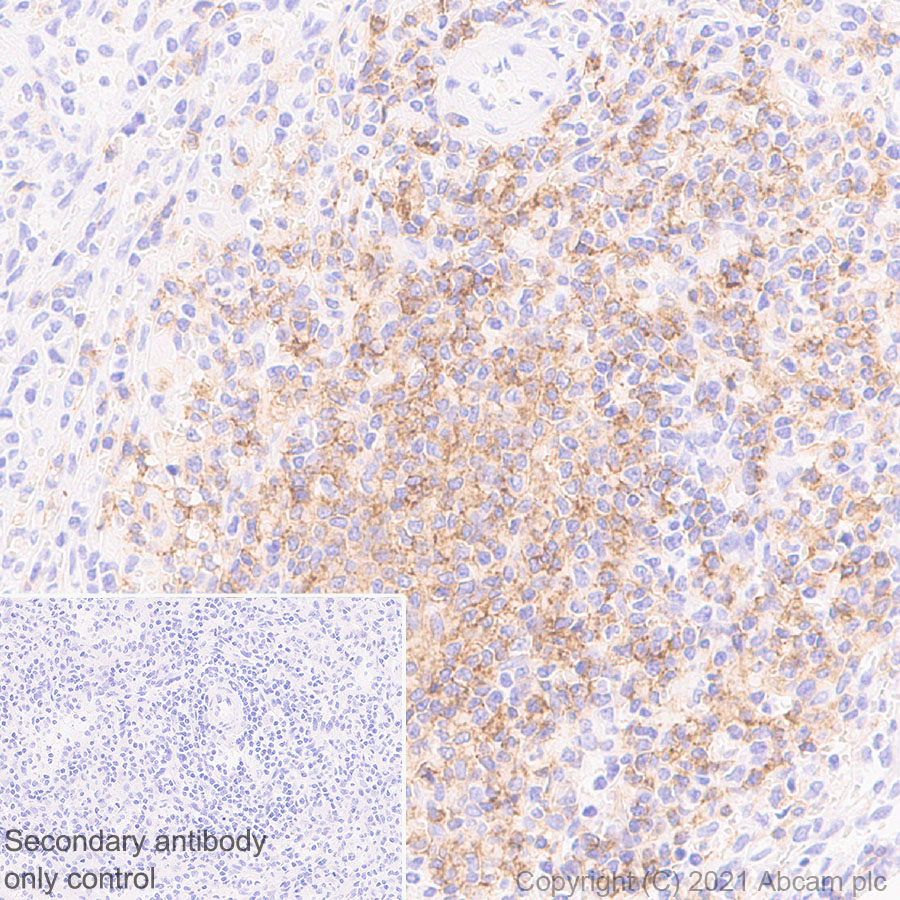 Immunohistochemistry (Formalin/PFA-fixed paraffin-embedded sections) - Anti-CD37 antibody [EPR25397-136] - BSA and Azide free (AB288448), expandable thumbnail
