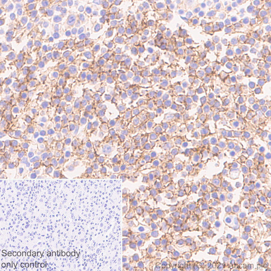 Immunohistochemistry (Formalin/PFA-fixed paraffin-embedded sections) - Anti-CD37 antibody [EPR25397-136] - BSA and Azide free (AB288448), expandable thumbnail