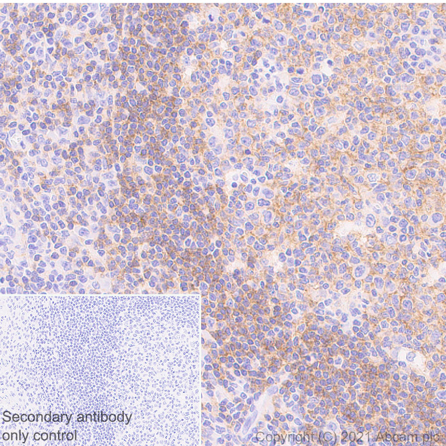 Immunohistochemistry (Formalin/PFA-fixed paraffin-embedded sections) - Anti-CD37 antibody [EPR25397-136] - BSA and Azide free (ab288448), expandable thumbnail