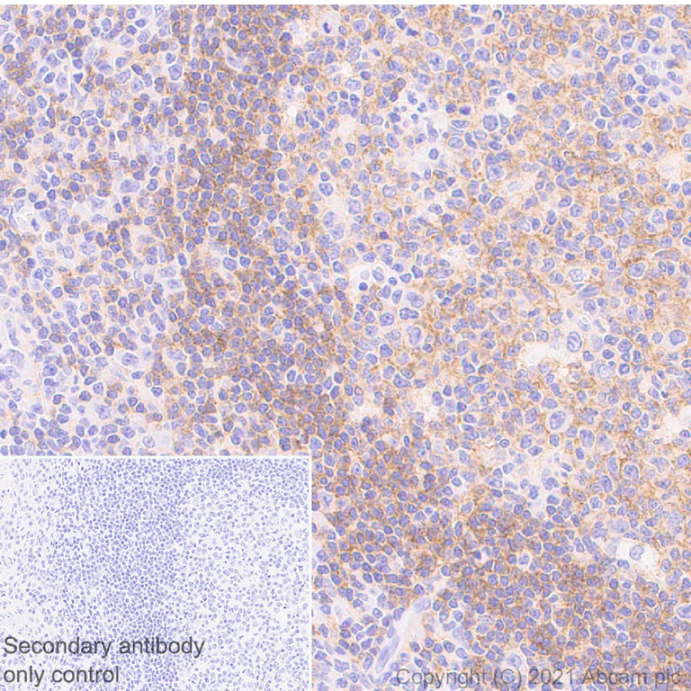 Immunohistochemistry (Formalin/PFA-fixed paraffin-embedded sections) - Anti-CD37 antibody [EPR25397-136] - BSA and Azide free (AB288448)