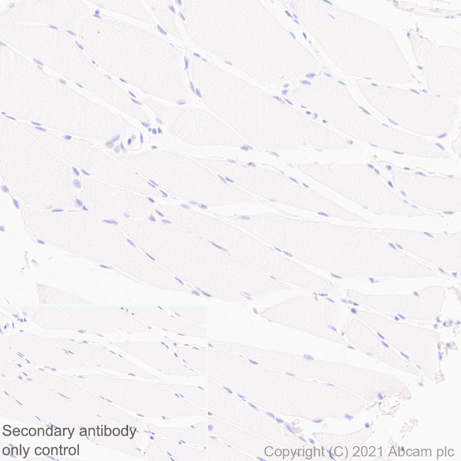 Immunohistochemistry (Formalin/PFA-fixed paraffin-embedded sections) - Anti-CD37 antibody [EPR25397-136] - BSA and Azide free (AB288448), expandable thumbnail