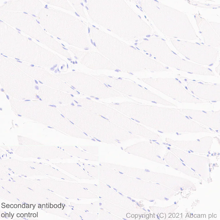 Immunohistochemistry (Formalin/PFA-fixed paraffin-embedded sections) - Anti-CD37 antibody [EPR25397-136] - BSA and Azide free (AB288448)