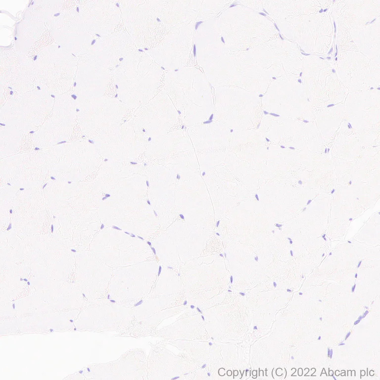 Immunohistochemistry (Formalin/PFA-fixed paraffin-embedded sections) - Anti-CD37 antibody [EPR25397-149] (AB300400)