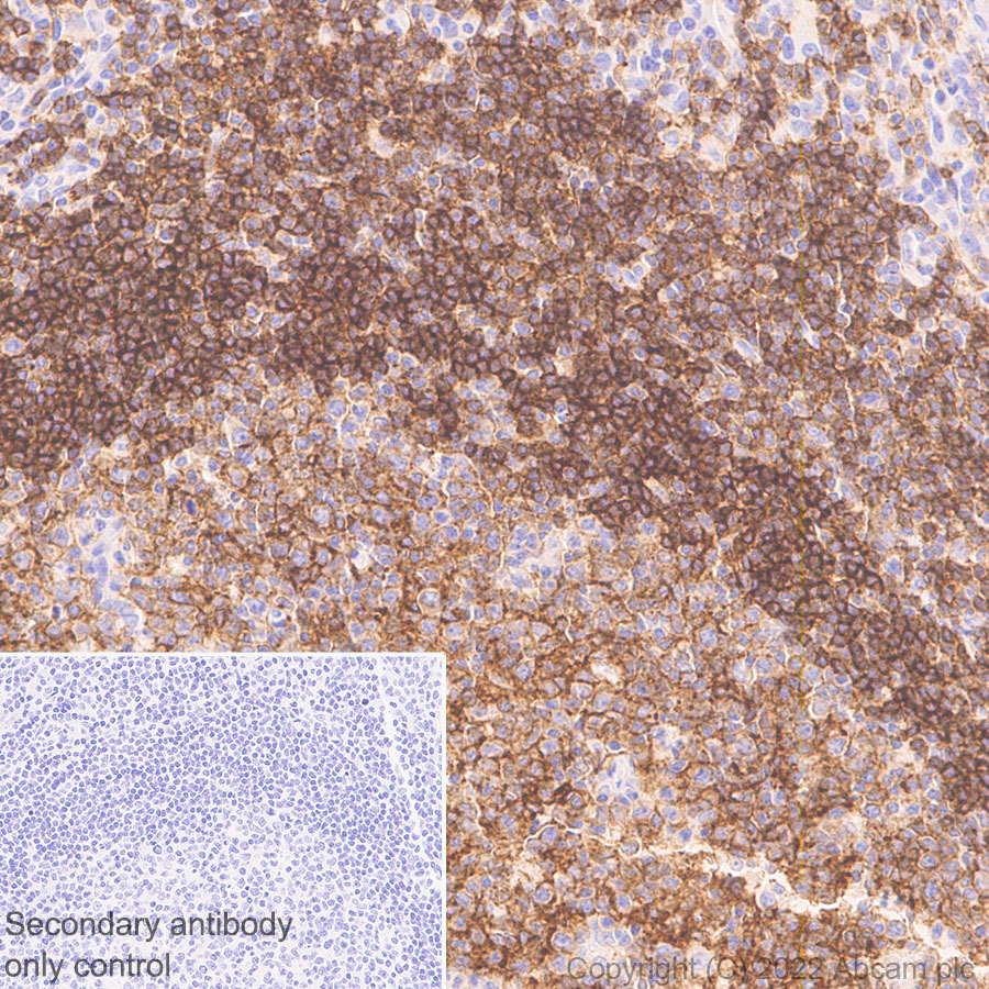 Immunohistochemistry (Formalin/PFA-fixed paraffin-embedded sections) - Anti-CD37 antibody [EPR25397-149] (BSA and Azide free) (ab300412), expandable thumbnail