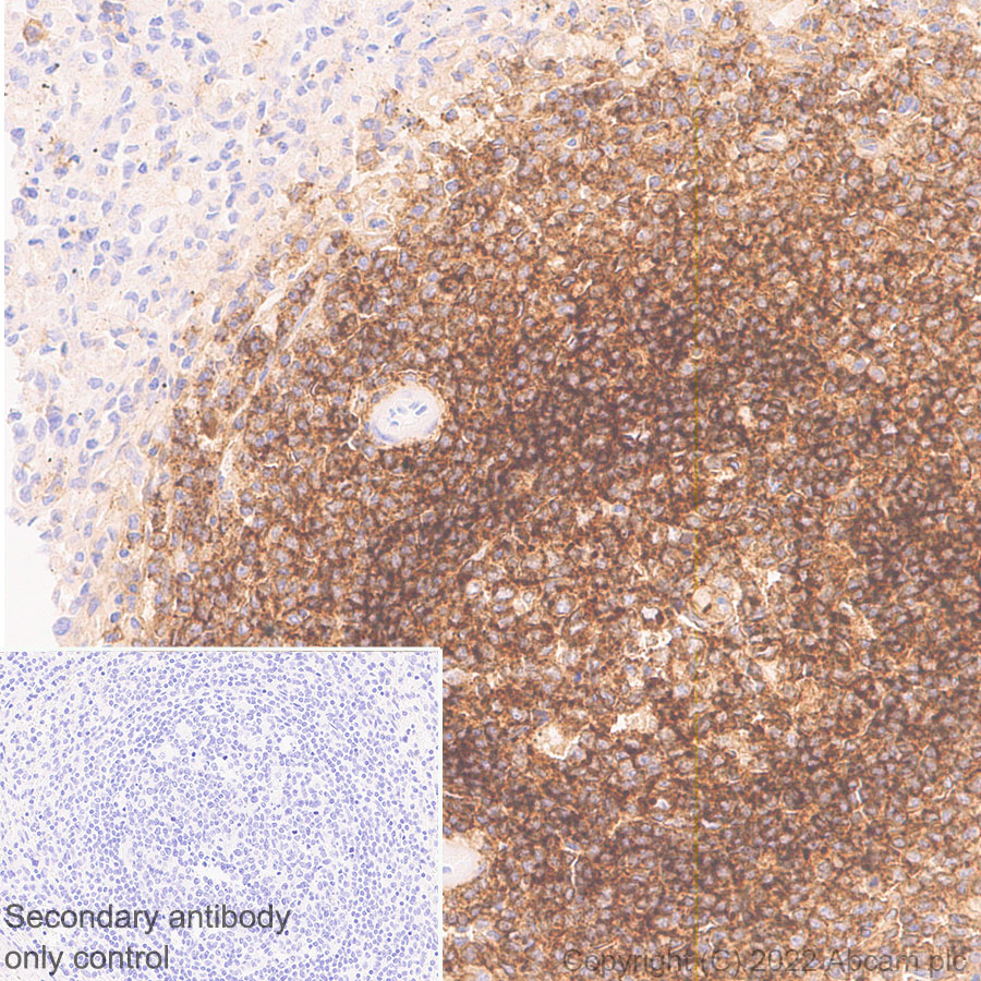 Immunohistochemistry (Formalin/PFA-fixed paraffin-embedded sections) - Anti-CD37 antibody [EPR25397-149] (BSA and Azide free) (ab300412), expandable thumbnail