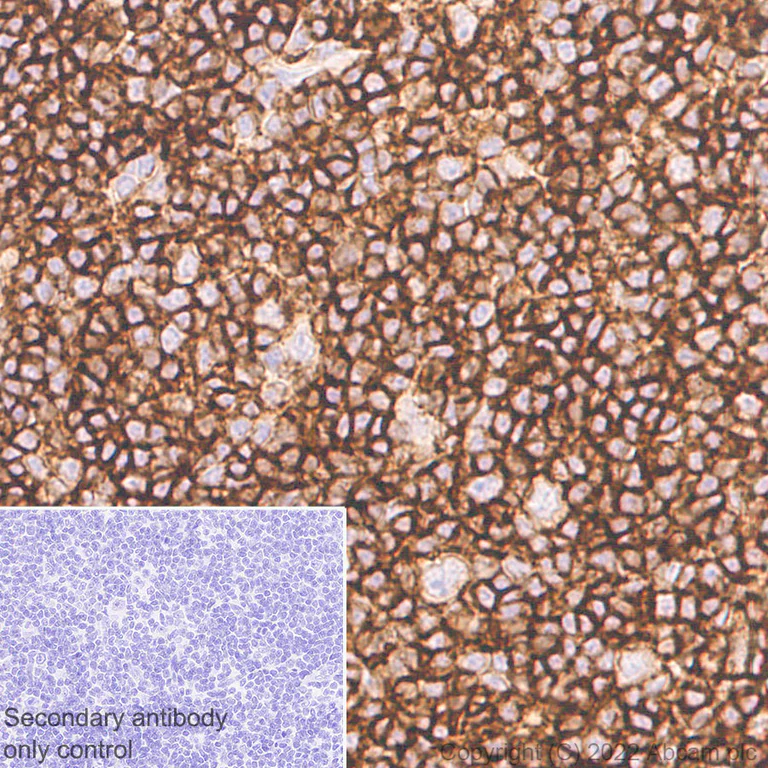 Immunohistochemistry (Formalin/PFA-fixed paraffin-embedded sections) - Anti-CD37 antibody [EPR25397-149] (BSA and Azide free) (AB300412)