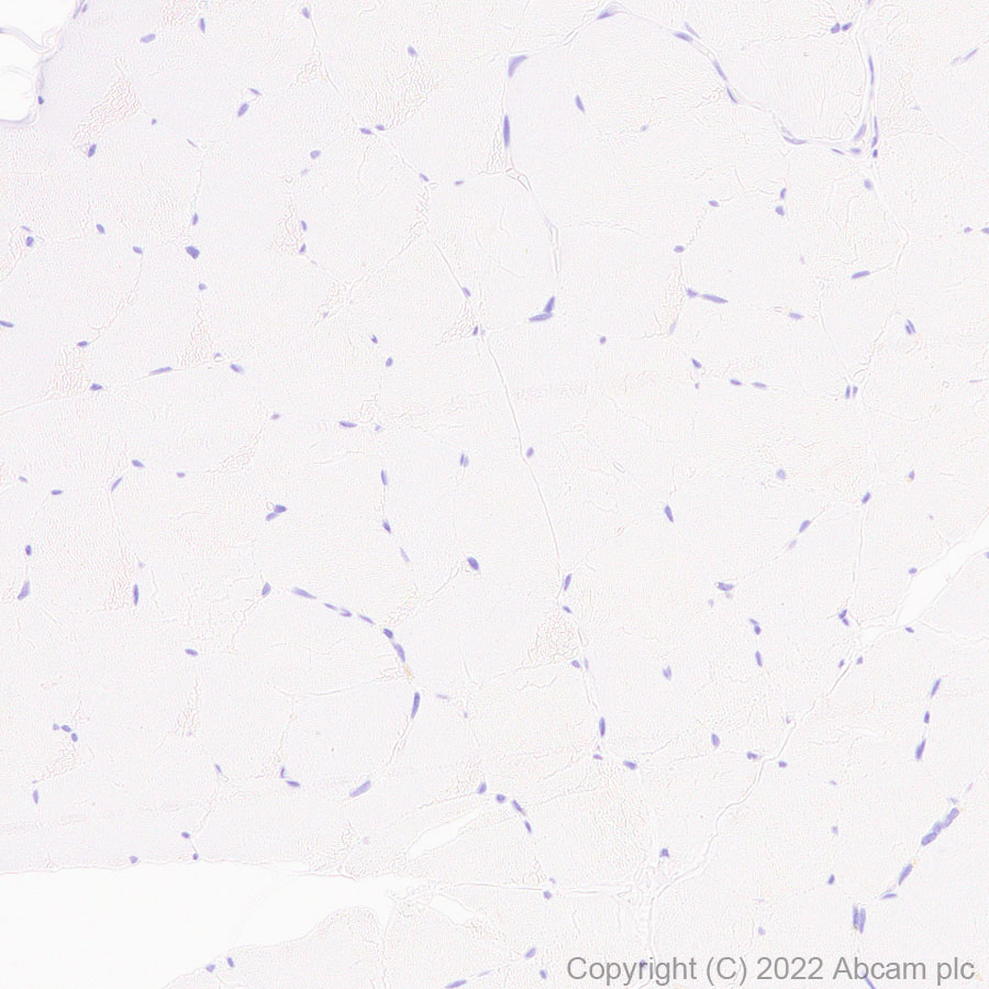 Immunohistochemistry (Formalin/PFA-fixed paraffin-embedded sections) - Anti-CD37 antibody [EPR25397-149] (BSA and Azide free) (ab300412), expandable thumbnail