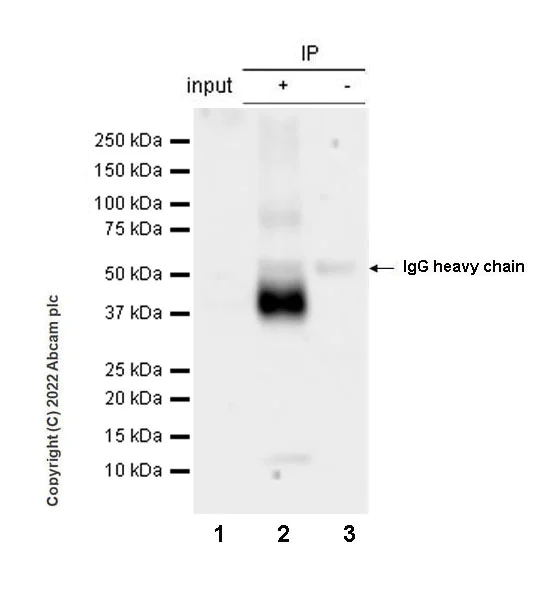 Immunoprecipitation - Anti-CD37 antibody [EPR25397-149] (BSA and Azide free) (AB300412)