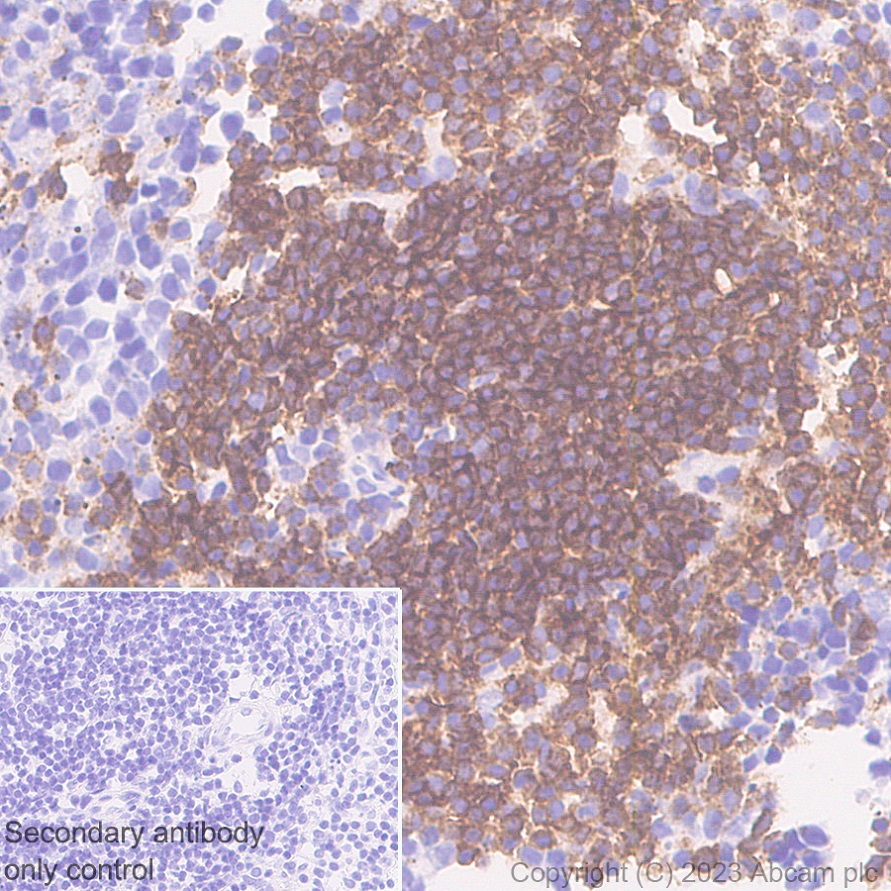 Immunohistochemistry (Formalin/PFA-fixed paraffin-embedded sections) - Anti-CD37 antibody [EPR28769-31] - BSA and Azide free (AB315347), expandable thumbnail