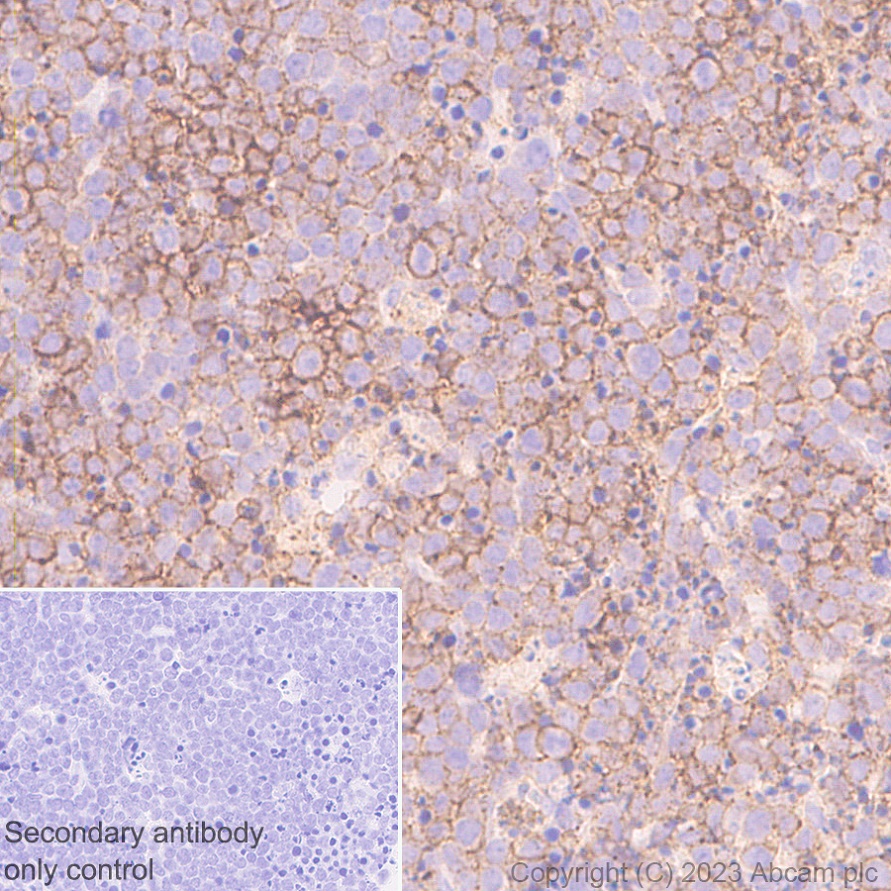 Immunohistochemistry (Formalin/PFA-fixed paraffin-embedded sections) - Anti-CD37 antibody [EPR28769-31] - BSA and Azide free (AB315347), expandable thumbnail