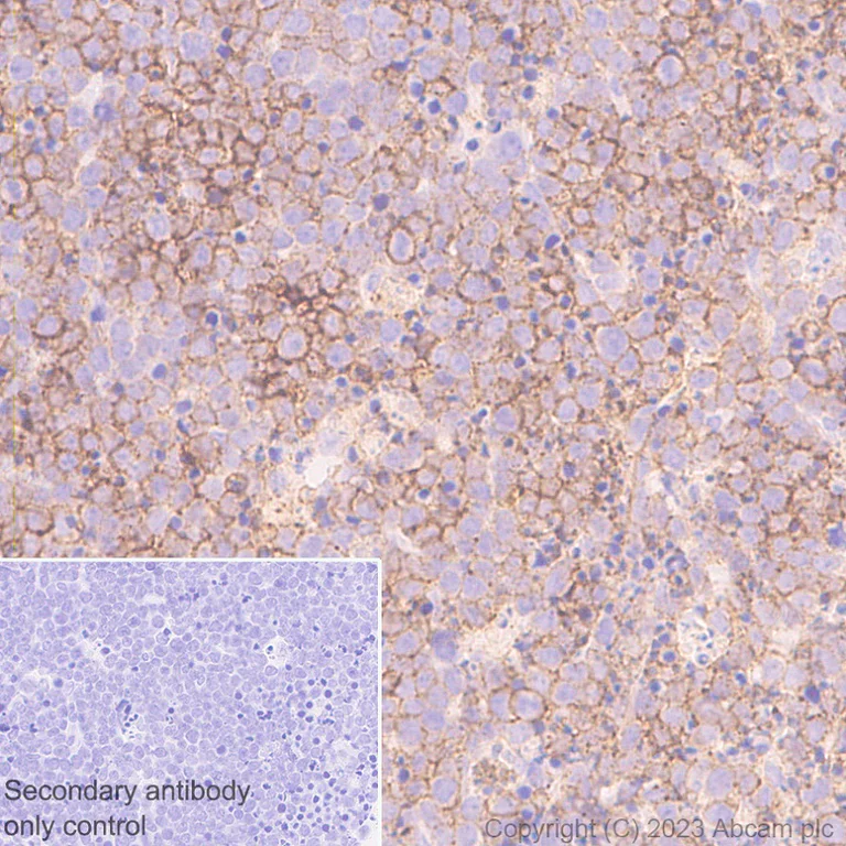Immunohistochemistry (Formalin/PFA-fixed paraffin-embedded sections) - Anti-CD37 antibody [EPR28769-31] - BSA and Azide free (AB315347)