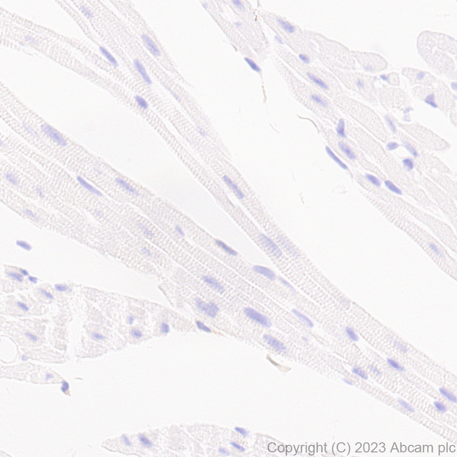 Immunohistochemistry (Formalin/PFA-fixed paraffin-embedded sections) - Anti-CD37 antibody [EPR28769-31] - BSA and Azide free (AB315347), expandable thumbnail