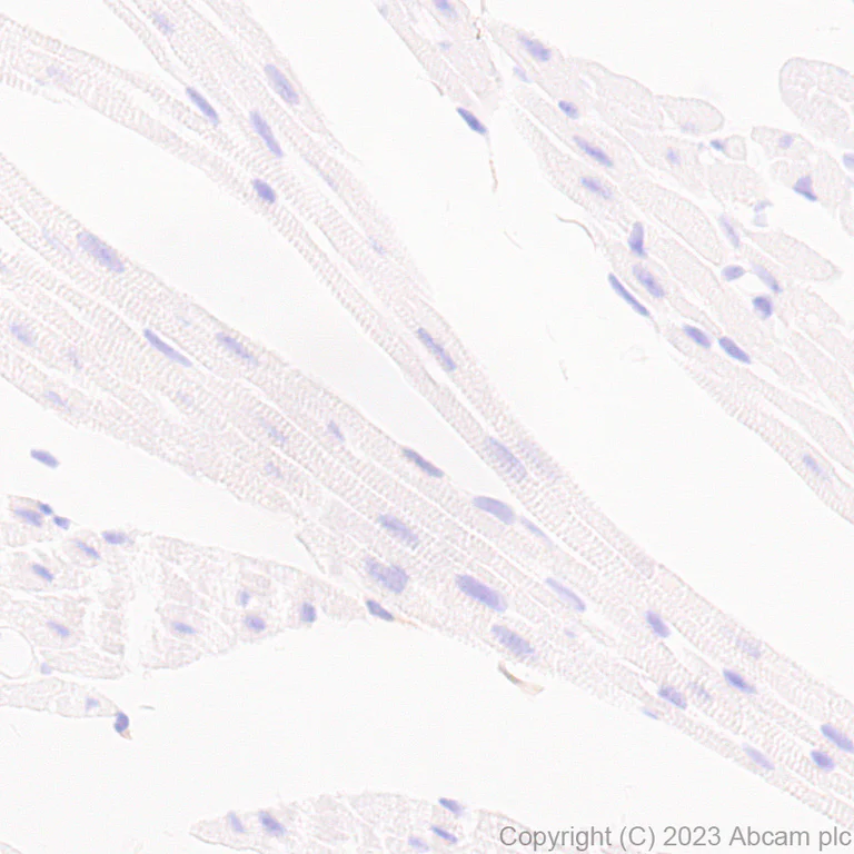 Immunohistochemistry (Formalin/PFA-fixed paraffin-embedded sections) - Anti-CD37 antibody [EPR28769-31] - BSA and Azide free (AB315347)