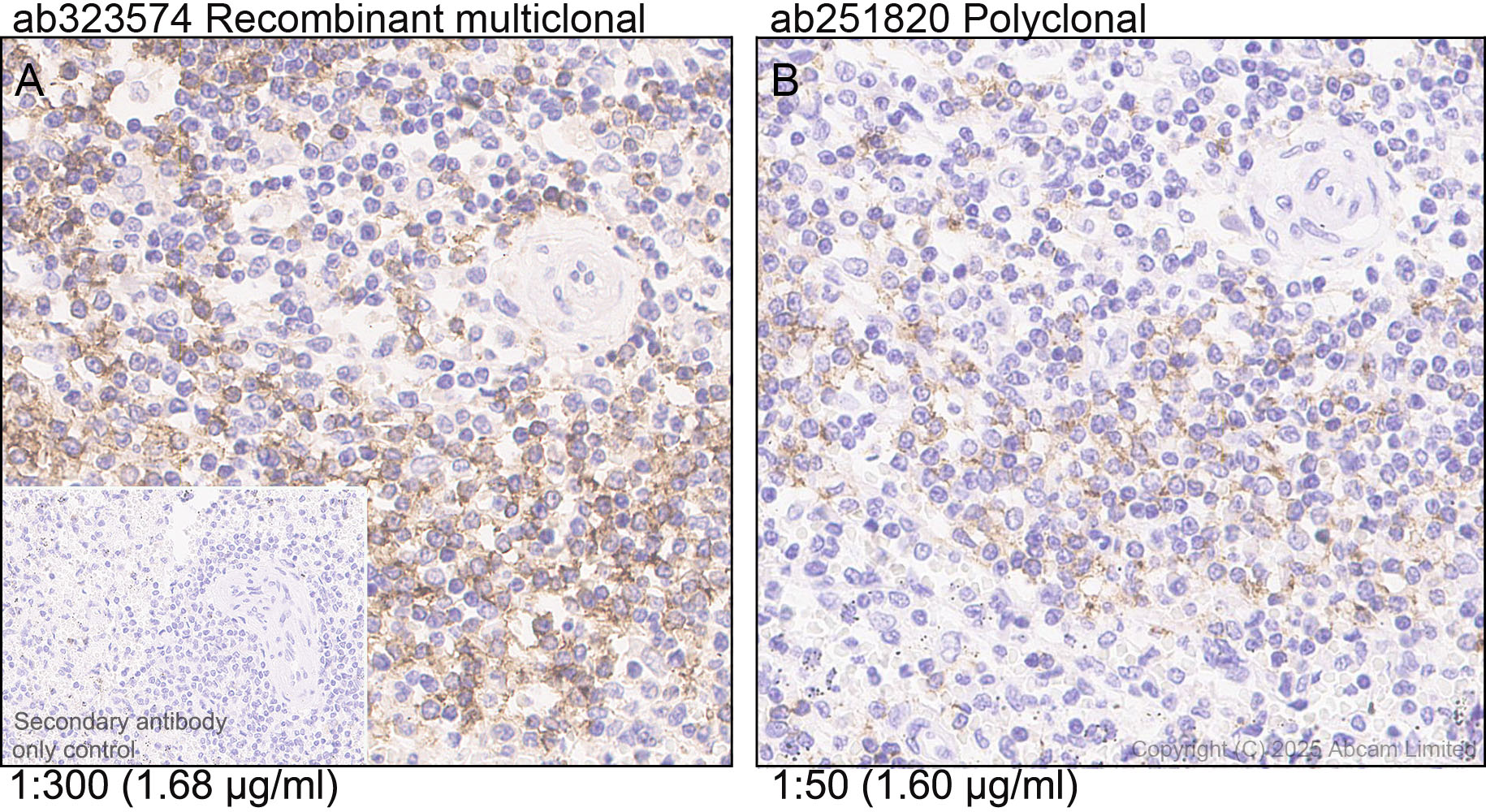 Immunohistochemistry (Formalin/PFA-fixed paraffin-embedded sections) - Anti-CD37 antibody [RM1306] (AB323574), expandable thumbnail