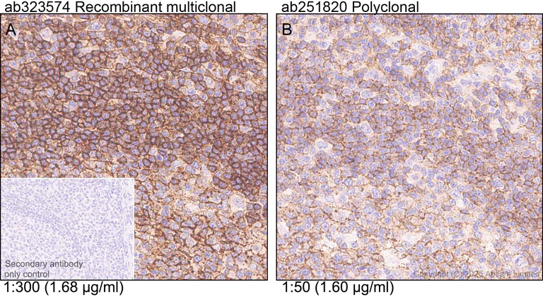 Immunohistochemistry (Formalin/PFA-fixed paraffin-embedded sections) - Anti-CD37 antibody [RM1306] (AB323574)