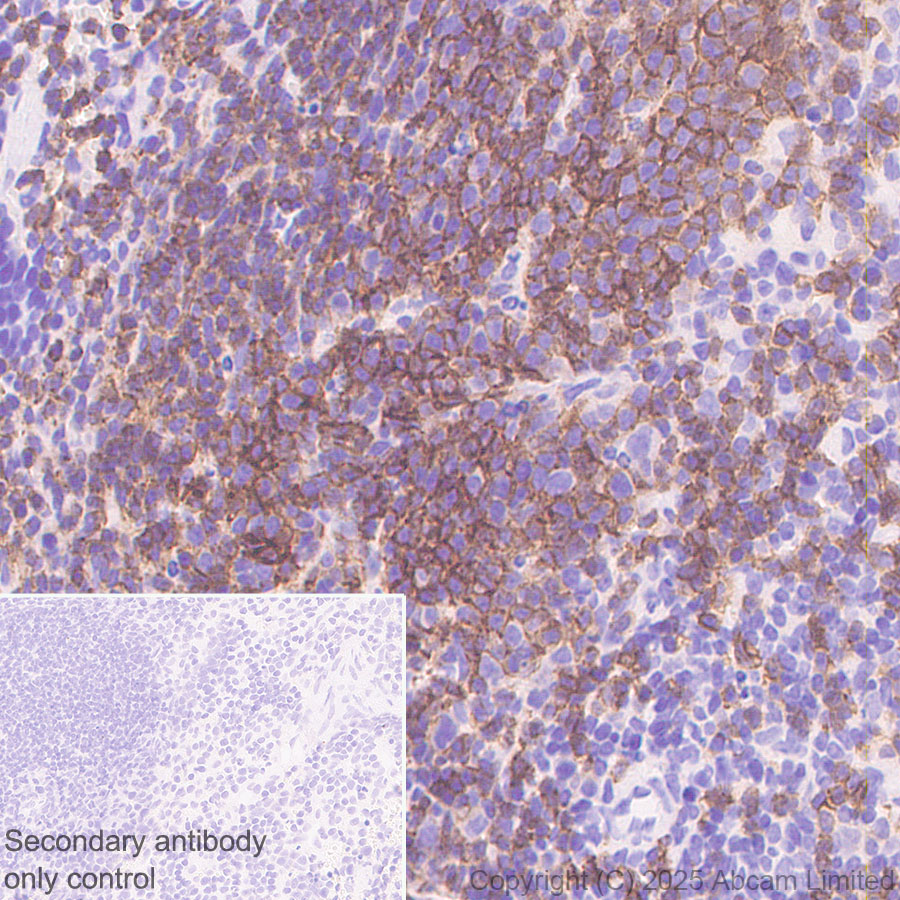 Immunohistochemistry (Formalin/PFA-fixed paraffin-embedded sections) - Anti-CD37 antibody [RM1306] (ab323574), expandable thumbnail