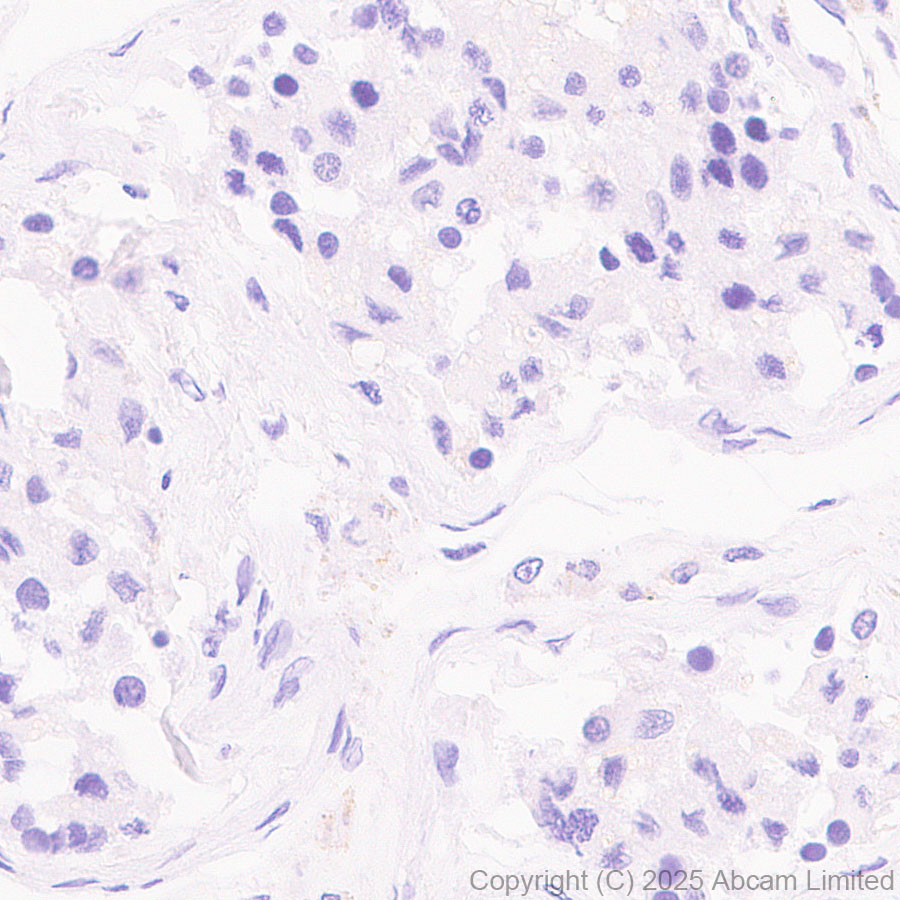 Immunohistochemistry (Formalin/PFA-fixed paraffin-embedded sections) - Anti-CD37 antibody [RM1306] (ab323574), expandable thumbnail