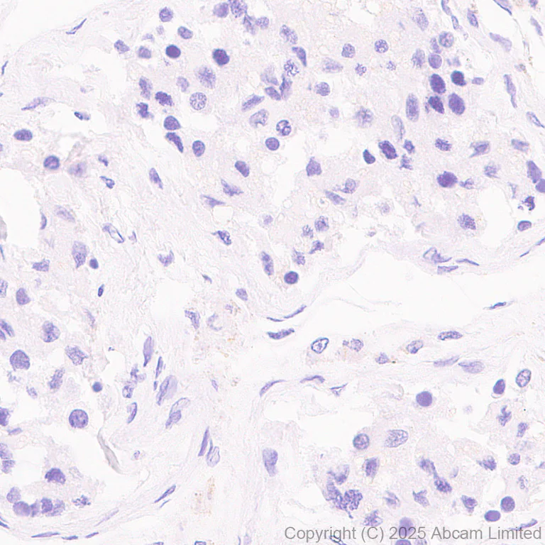 Immunohistochemistry (Formalin/PFA-fixed paraffin-embedded sections) - Anti-CD37 antibody [RM1306] (AB323574)