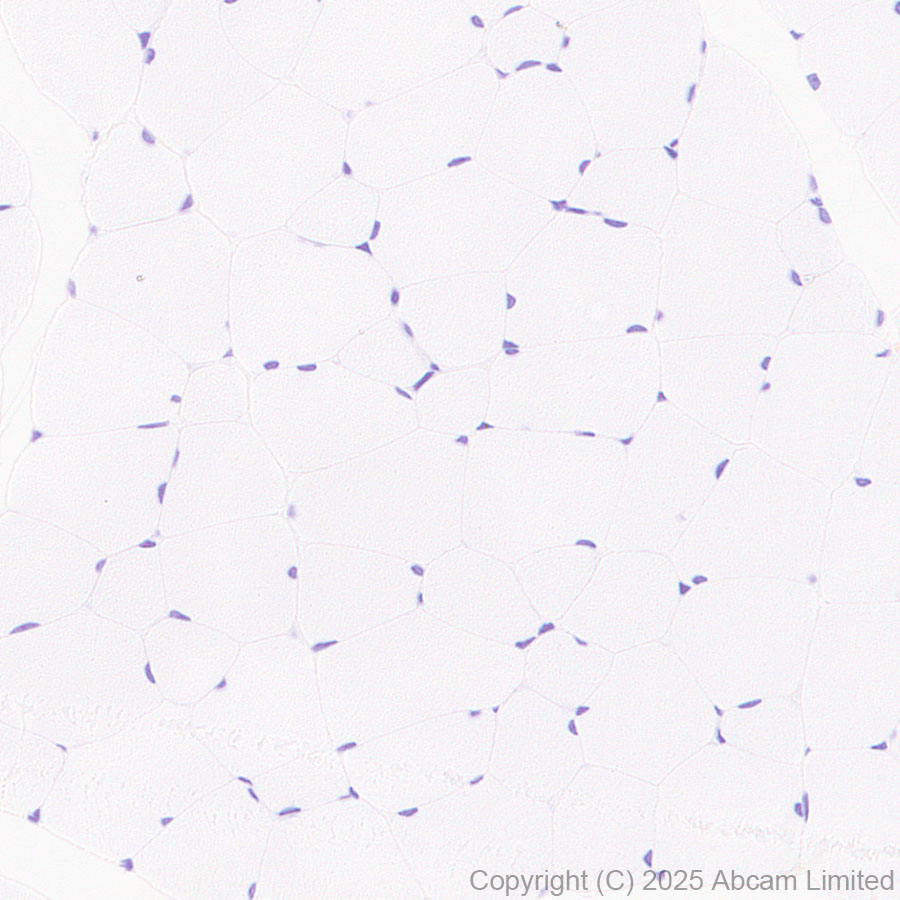 Immunohistochemistry (Formalin/PFA-fixed paraffin-embedded sections) - Anti-CD37 antibody [RM1306] (ab323574), expandable thumbnail