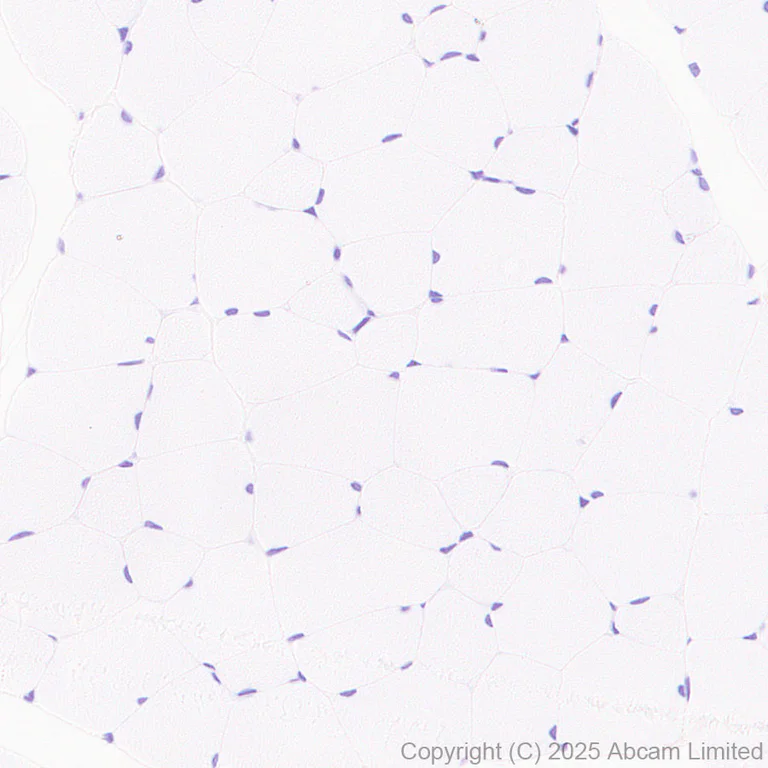 Immunohistochemistry (Formalin/PFA-fixed paraffin-embedded sections) - Anti-CD37 antibody [RM1306] (AB323574)