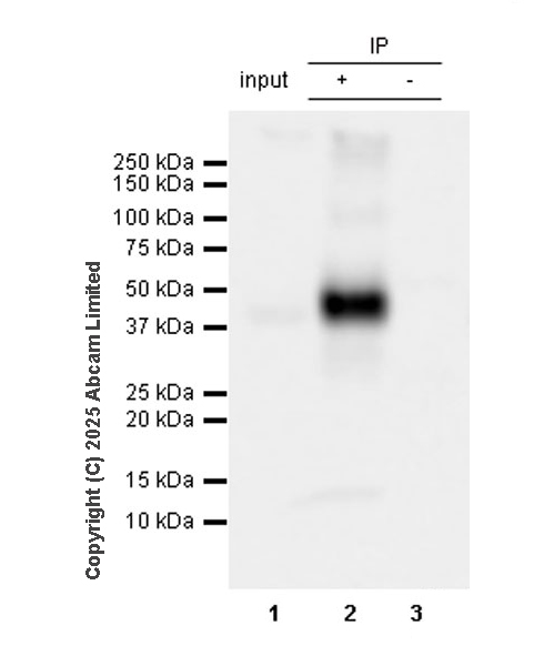 Immunoprecipitation - Anti-CD37 antibody [RM1306] (AB323574), expandable thumbnail