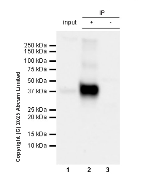 Immunoprecipitation - Anti-CD37 antibody [RM1306] (AB323574), expandable thumbnail