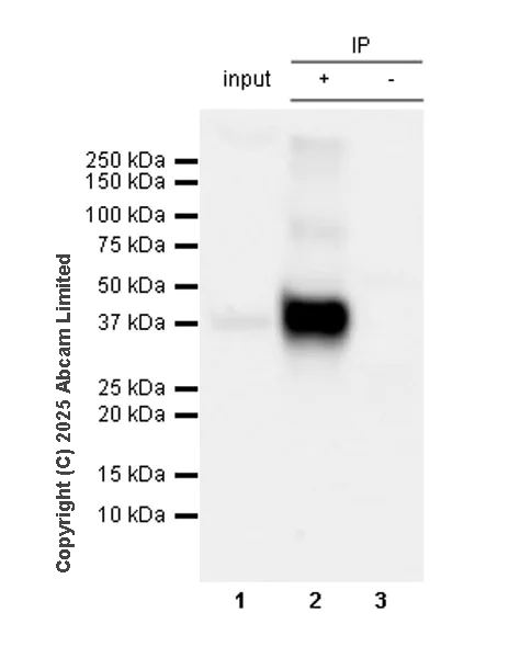 Immunoprecipitation - Anti-CD37 antibody [RM1306] (AB323574)