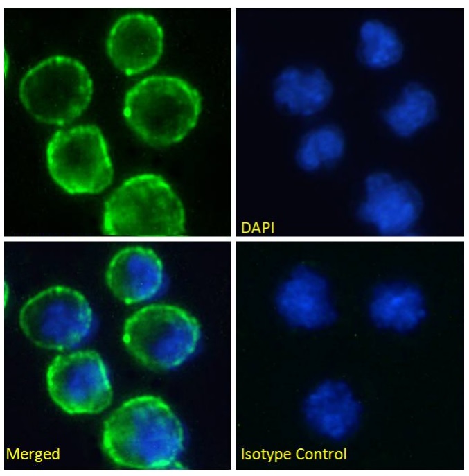 Immunocytochemistry/ Immunofluorescence - Anti-CD37 antibody [WR17] (AB245680)